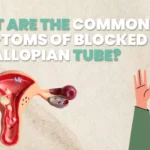 What are the Common Symptoms of Blocked Fallopian Tube?