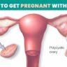 How to Get Pregnant with PCOS