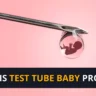 What is test tube baby process?