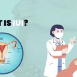 What is IUI?
