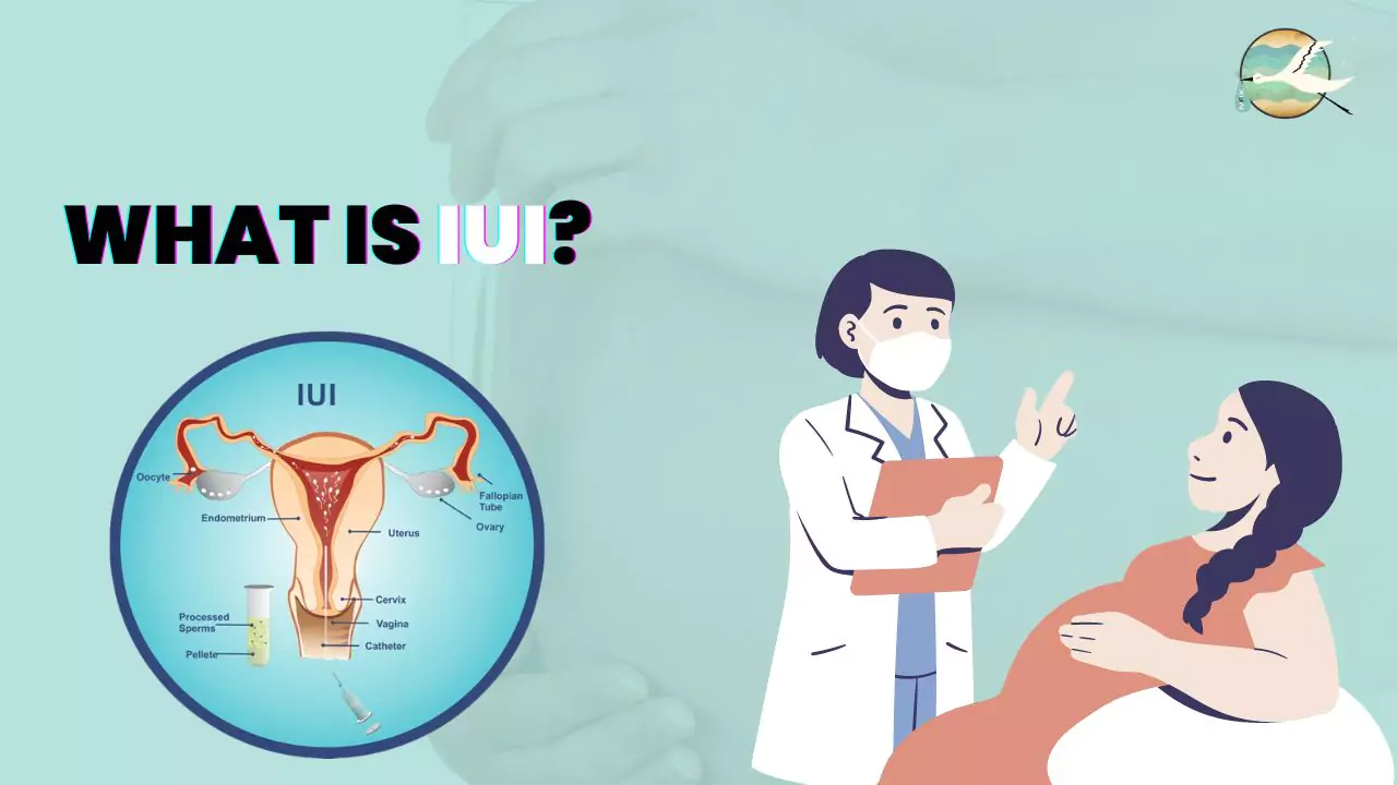 What is IUI?