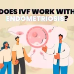 Does IVF work with endometriosis?