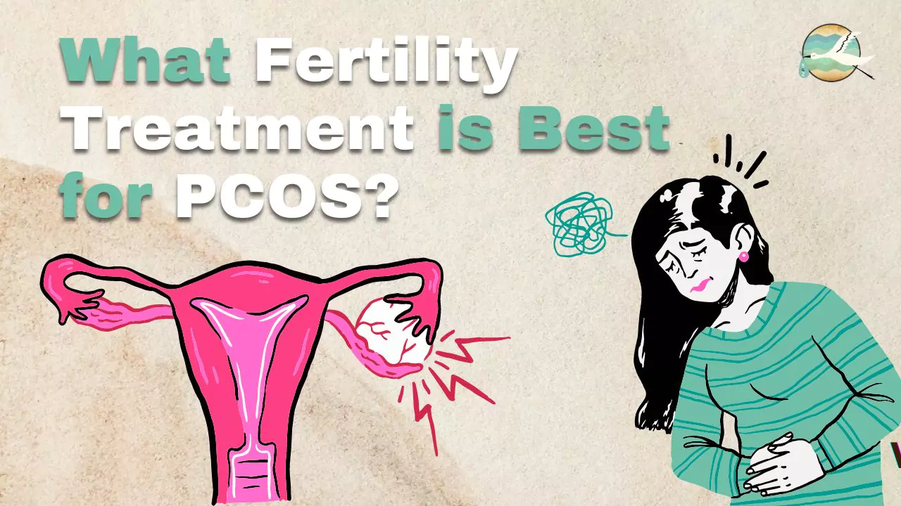 What Fertility Treatment is Best for PCOS?