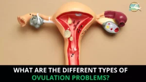 What are the different types of ovulation problems?