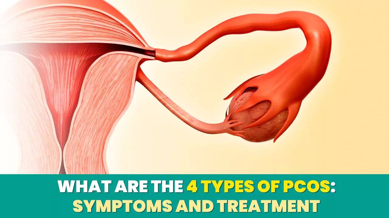 What are the 4 types of PCOS: Symptoms and Treatment