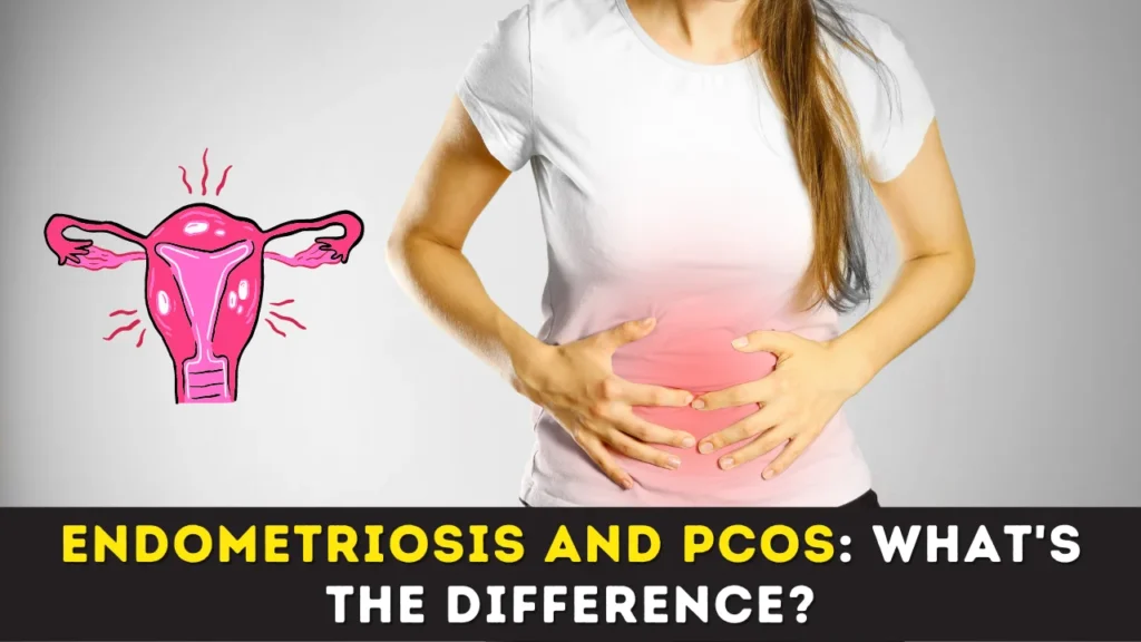 Endometriosis and PCOS: What's the difference?