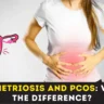 Endometriosis and PCOS: What's the difference?